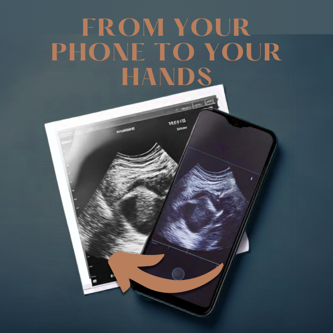 Cherish Every Moment with a Traditional Ultrasound Print