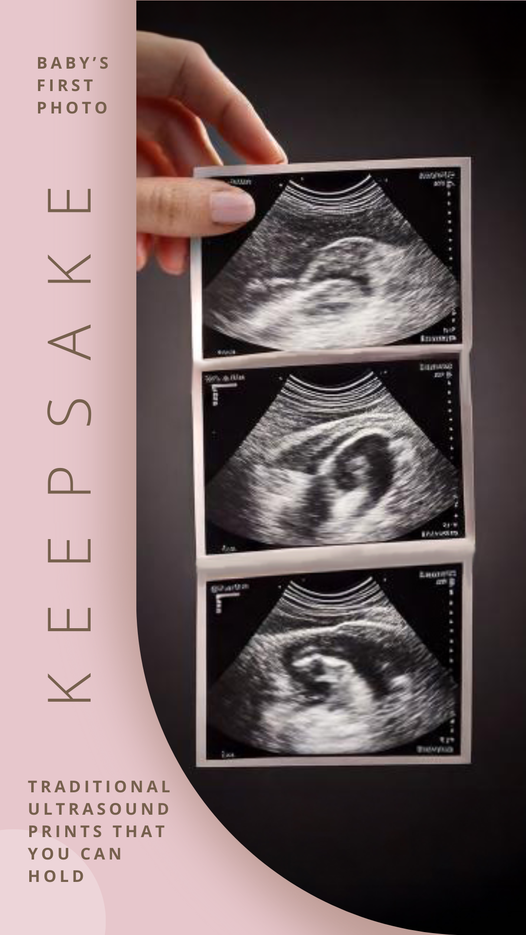 Cherish Every Moment with a Traditional Ultrasound Print