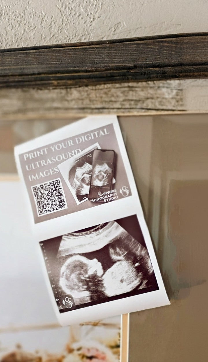 Traditional Ultrasound Print - Upload your Images