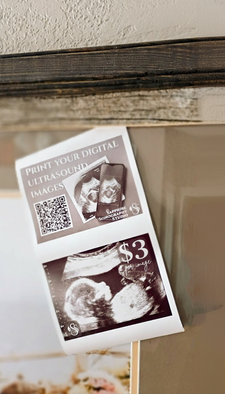 Traditional Ultrasound Print - Upload your Images